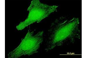 Immunofluorescence of  purified  MaxPab antibody to CLUHP3 on HeLa cell. (CLUHP3 anticorps  (AA 1-147))