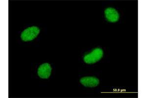 Immunofluorescence of purified MaxPab antibody to SMARCAL1 on HeLa cell. (SMARCAL1 anticorps  (AA 1-954))