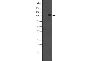 Western blot analysis of MCF2 expression in K562 cell line lysate ;,The lane on the left is treated with the antigen-specific peptide. (MCF2 anticorps  (Internal Region))
