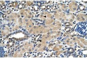 Immunohistochemical staining (Formalin-fixed paraffin-embedded sections) of human kidney with ASPH polyclonal antibody  at 4-8 ug/mL working concentration. (Aspartate beta Hydroxylase anticorps  (N-Term))