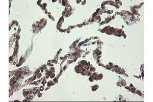 Image no. 7 for anti-Ubiquitin-Conjugating Enzyme E2, J1, U (UBE2J1) antibody (ABIN1501638)