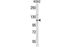 Western blot analysis using EIF3CL Antibody (N-term) Cat. (EIF3C anticorps  (N-Term))