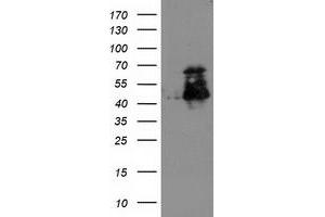 Western Blotting (WB) image for anti-ELK3, ETS-Domain Protein (SRF Accessory Protein 2) (ELK3) antibody (ABIN1498007)