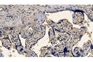 Detection of TGFb1 in Human Placenta Tissue using Polyclonal Antibody to Transforming Growth Factor Beta 1 (TGFb1)