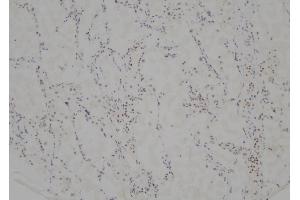 ABIN6268828 at 1/100 staining Human lung tissue by IHC-P. (DDIT3 anticorps  (Internal Region))