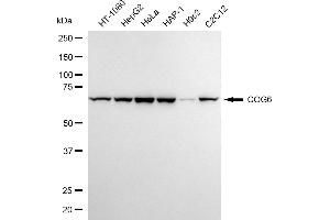 Western blotting analysis using COG6 antibody (ABIN7798145).