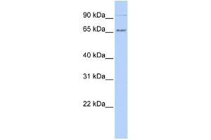 WB Suggested Anti-IKZF4 Antibody Titration:  0. (IKZF4 anticorps  (N-Term))