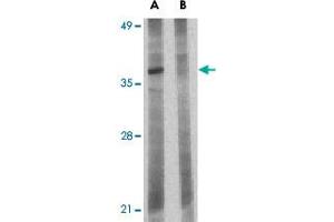 Western blot analysis of BCL2L10 in Jurkat lysate with BCL2L10 polyclonal antibody  at 1 ug/mL in the (A) absence and (B) presence of blocking peptide.