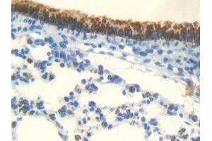 IHC-P analysis of Mouse Lung Tissue, with DAB staining. (Androgen Receptor anticorps  (AA 156-310))