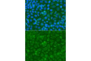 Immunofluorescence analysis of A549 cell using ACAD9 antibody. (ACAD9 anticorps)