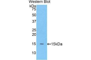 Western Blotting (WB) image for anti-Meningioma Expressed Antigen 5 (Hyaluronidase) (MGEA5) (AA 695-814) antibody (ABIN1859959) (MGEA5 anticorps  (AA 695-814))