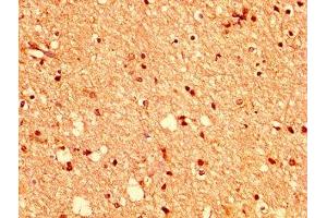 IHC image of ABIN7151835 diluted at 1:400 and staining in paraffin-embedded human brain tissue performed on a Leica BondTM system. (EPH Receptor A2 anticorps  (AA 627-976))