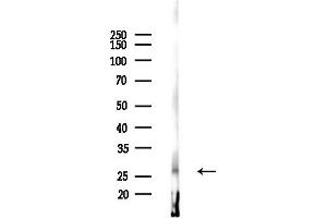 anti-Neural Retina Leucine Zipper (NRL) (N-Term) antibody