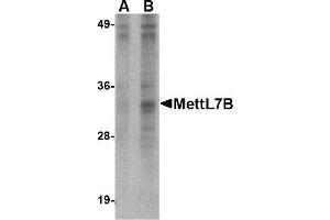 Western Blotting (WB) image for anti-Methyltransferase Like 7B (METTL7B) (N-Term) antibody (ABIN1031456) (METTL7B anticorps  (N-Term))