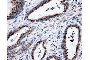 Immunohistochemistry (IHC) image for anti-Induced Myeloid Leukemia Cell Differentiation Protein Mcl-1 (MCL1) antibody (ABIN1499340)