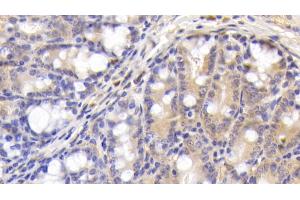 Detection of C4B in Mouse Colon Tissue using Polyclonal Antibody to Complement C4-B (C4B) (C4B anticorps  (AA 126-366))