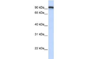 WB Suggested Anti-TMEM168 Antibody Titration:  0.