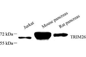Western blot analysis of TRIM26 (ABIN7076014) at dilution of 1: 1500 (TRIM26 anticorps)