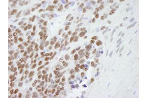 Immunohistochemistry (IHC) image for anti-Chromobox Homolog 3 (CBX3) (C-Term) antibody (ABIN7448460) (CBX3 anticorps  (C-Term))