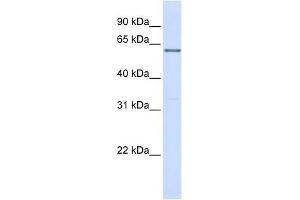PPP2R3B antibody used at 1 ug/ml to detect target protein. (PPP2R3B anticorps)