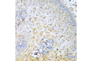 Immunohistochemistry of paraffin-embedded human esophagus using MYH9 antibody. (Myosin 9 anticorps)