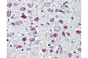 Immunohistochemical staining of FTO with anti-FTO (human), mAb (AG103)  in brain, hypothalamus and paraventricular nucleus (5~10 μg/ml).