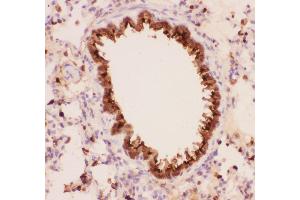 Anti-Annexin A1 Picoband antibody,  IHC(P): Rat Lung Tissue