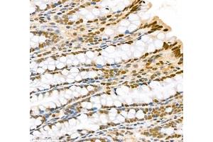 Immunohistochemistry of paraffin embedded rat colon using Transketolase (ABIN7075978) at dilution of 1: 2200 (400x lens)