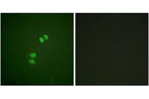 Immunofluorescence analysis of A549 cells, using PLK1 (Ab-210) Antibody.