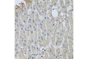 Immunohistochemistry of paraffin-embedded human liver injury using SYT11 antibody at dilution of 1:100 (x40 lens). (SYT11 anticorps)