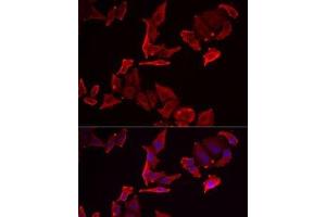 Immunofluorescence analysis of MCF7 cells using SKAP2 Polyclonal Antibody (SKAP2 anticorps)