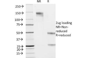 SDS-PAGE Analysis Purified Cytokeratin 19 Mouse Monoclonal Antibody (KRT19/799).