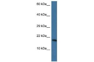 Western Blot showing Pnkd antibody used at a concentration of 1. (PNKD anticorps  (N-Term))