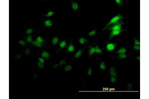 Immunofluorescence of monoclonal antibody to ZNF496 on HeLa cell.