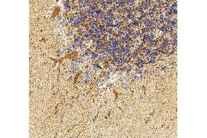 IHC analysis of PAK3 using anti-PAK3 antibody (ABIN7599182).