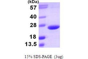 SDS-PAGE (SDS) image for Tumor Necrosis Factor (Ligand) Superfamily, Member 15 (TNFSF15) (AA 72-251) protein (His tag) (ABIN666796)