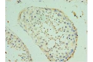Immunohistochemistry of paraffin-embedded human testis tissue using ABIN7170476 at dilution of 1:100