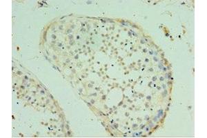 Immunohistochemistry of paraffin-embedded human testis tissue using ABIN7170476 at dilution of 1:100 (SPAG16 anticorps  (AA 1-183))