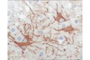 Immunohistochemistry (IHC) image for anti-Feline Sarcoma Oncogene (FES) (truncated) antibody (ABIN2464051)