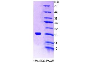 Image no. 1 for CD7 (CD7) (AA 24-150) protein (T7 tag,His tag) (ABIN6238918)