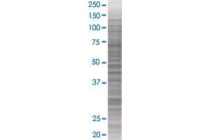 FCGR2B transfected lysate. (FCGR2B 293T Cell Transient Overexpression Lysate(Denatured))