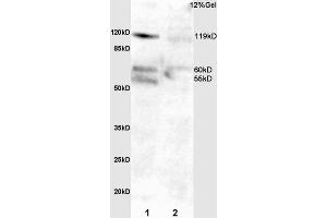 L1 mouse intestine lysate L2 rat lung lysates probed with Anti Phospho-FAK (Tyr397)Polyclonal Antibody, Unconjugated  at 1:3000 for 90 min at 37˚C. (FAK anticorps  (pTyr397))