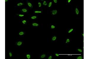 Immunofluorescence of monoclonal antibody to RAD18 on HeLa cell. (RAD18 anticorps  (AA 332-430))