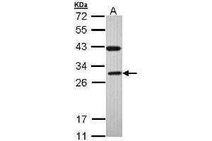 WB Image Sample (30 ug of whole cell lysate) A: H1299 12% SDS PAGE antibody diluted at 1:1000 (Rab3c anticorps)
