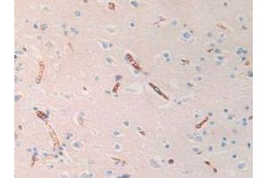 IHC-P analysis of Human Brain Tissue, with DAB staining. (HBd anticorps  (AA 1-143))
