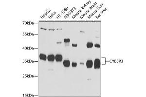 Western blot analysis of extracts of various cell lines, using CYB5R3 antibody (ABIN6127675, ABIN6139298, ABIN6139299 and ABIN6223438) at 1:1000 dilution. (CYB5R3 anticorps  (AA 125-334))