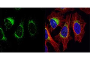 ICC/IF Image Tyrosine Hydroxylase antibody [N1C1] detects Tyrosine Hydroxylase protein at cytoplasm by immunofluorescent analysis. (Tyrosine Hydroxylase anticorps)