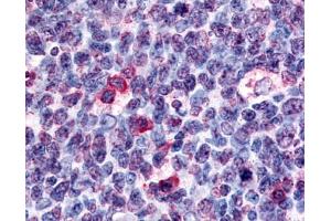 Anti-GPR146 antibody IHC of human tonsil germinal center.