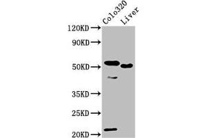 Western Blot Positive WB detected in: Colo320 whole cell lysate, Rat liver tissue All lanes: OLFM4 antibody at 10 μg/mL Secondary Goat polyclonal to rabbit IgG at 1/50000 dilution Predicted band size: 58 kDa Observed band size: 58 kDa (Olfactomedin 4 anticorps  (AA 224-334))