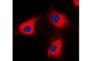 Immunofluorescent analysis of BCKDK staining in HeLa cells. (BCKDK anticorps  (N-Term))